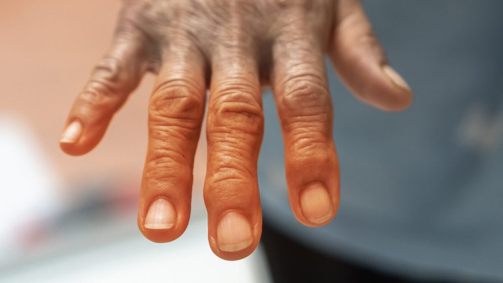 cbd products for pain - How to Use CBD for Inflammation cbd-products-for-pain